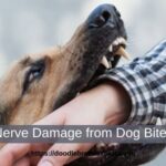 Nerve Damage from Dog Bite